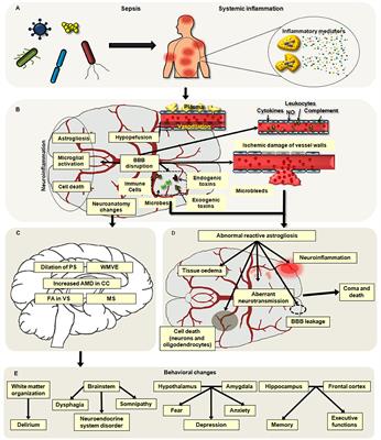 Neuroimmune Regulation in Sepsis-Associated Encephalopathy: The Interaction Between the Brain and Peripheral Immunity
